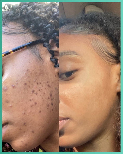 Green Mask Stick – Masque Purifiant & Anti-Points Noirs 🌱