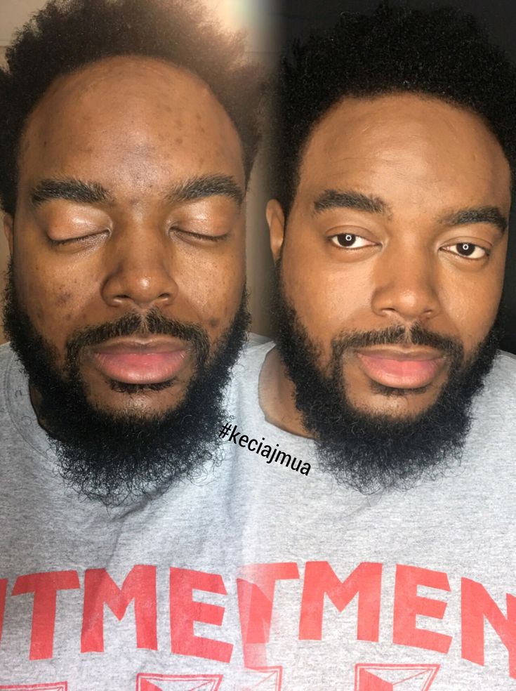 Green Mask Stick – Masque Purifiant & Anti-Points Noirs 🌱